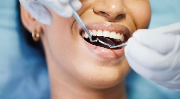 Best Emergency Dentist for Knocked-Out Tooth in Port Jervis, NY